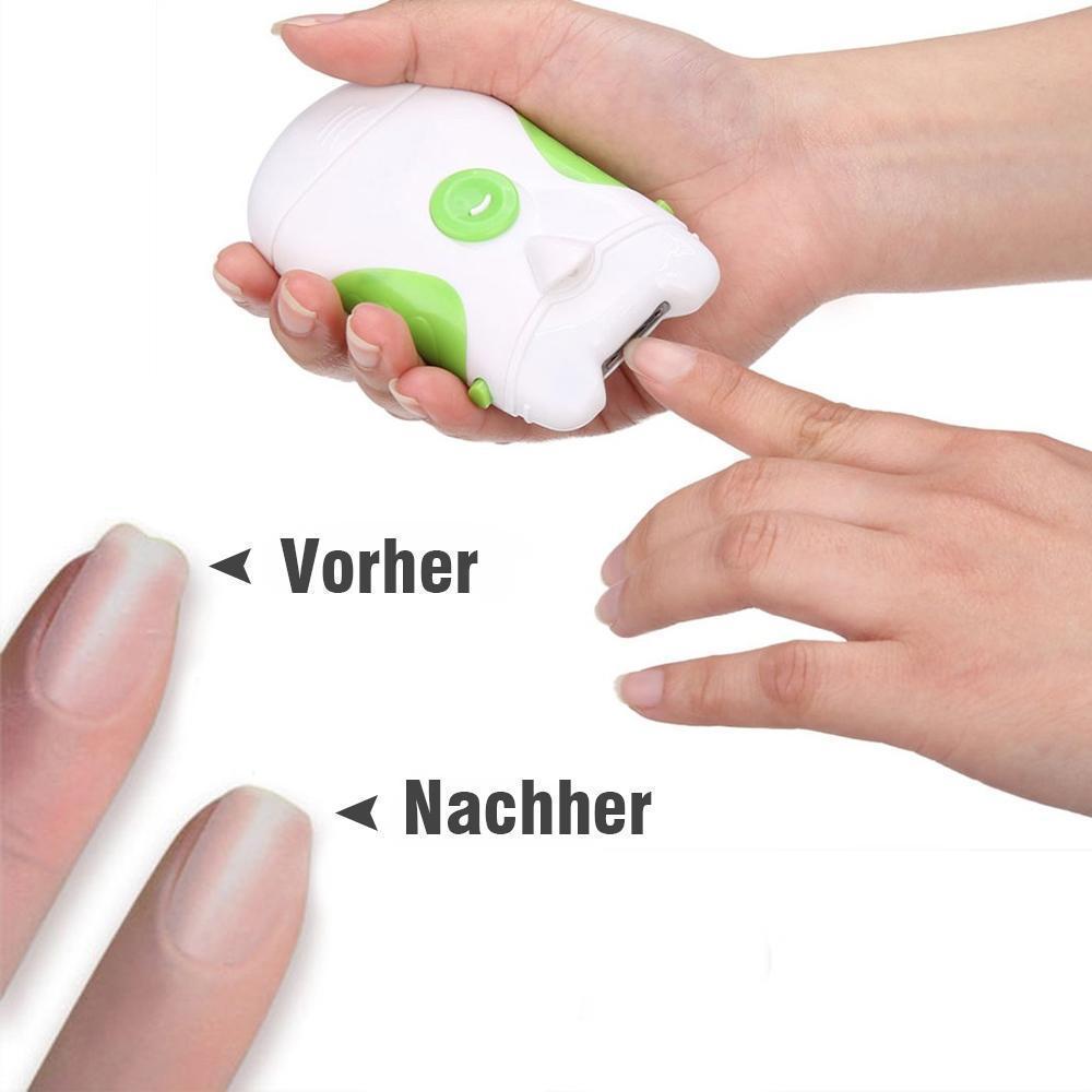 Bequee Elektrischer Nagelschneider mit LED-Licht