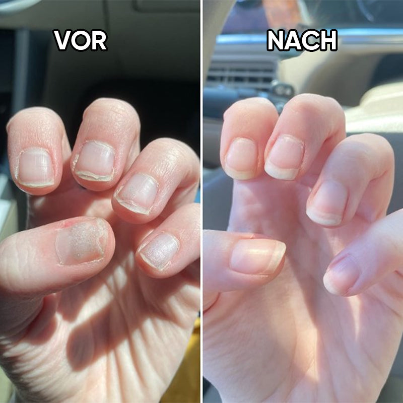 💅Ölstift für die Nagelernährung💕