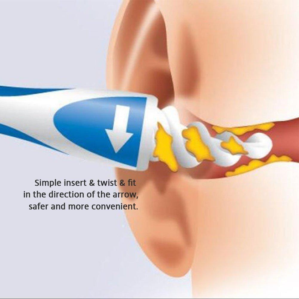 Ohrenschmalz Entferner, mit 16 abwaschbaren Ersatzspitzen